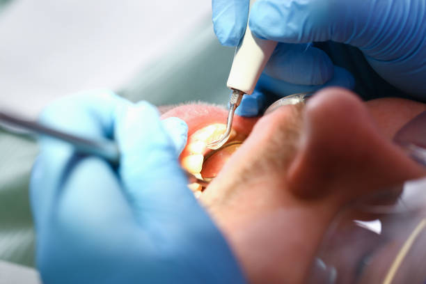 Best Emergency Denture Repair in Pymatuning Central, PA