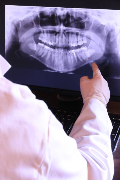 Best Emergency Dental Care for Broken or Chipped Teeth in Pymatuning Central, PA